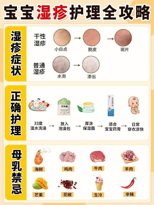 宝宝湿性湿疹怎么治疗