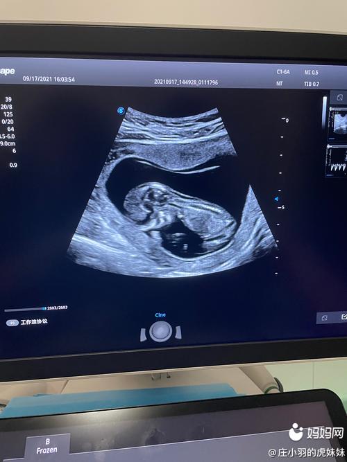 做nt宝宝一直趴着怎么办