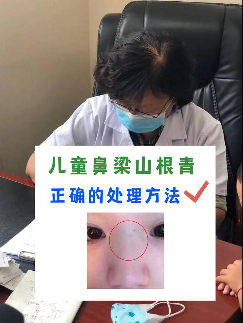 宝宝鼻梁发青是怎么回事
