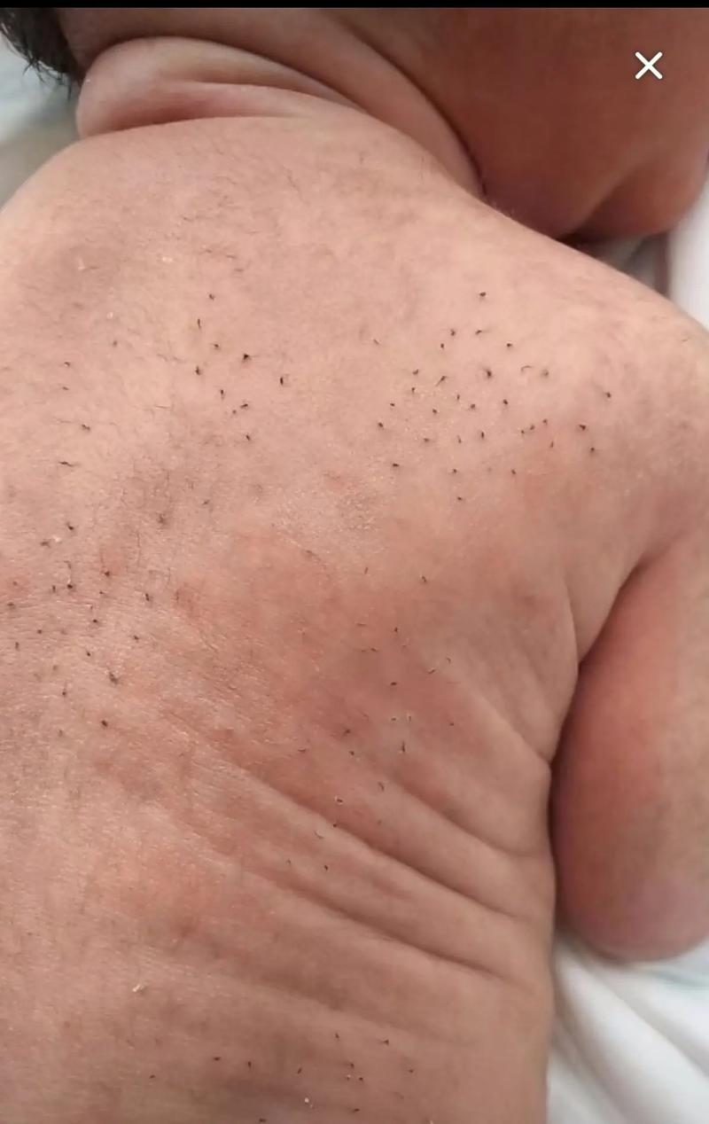 宝宝有风怎么去除