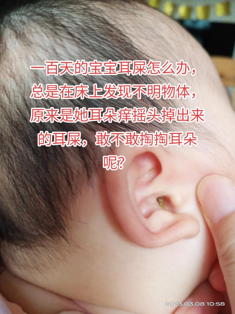 宝宝耳朵的耳屎怎么办