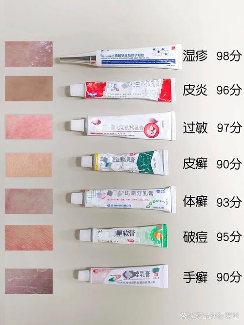 宝宝怎么去湿疹