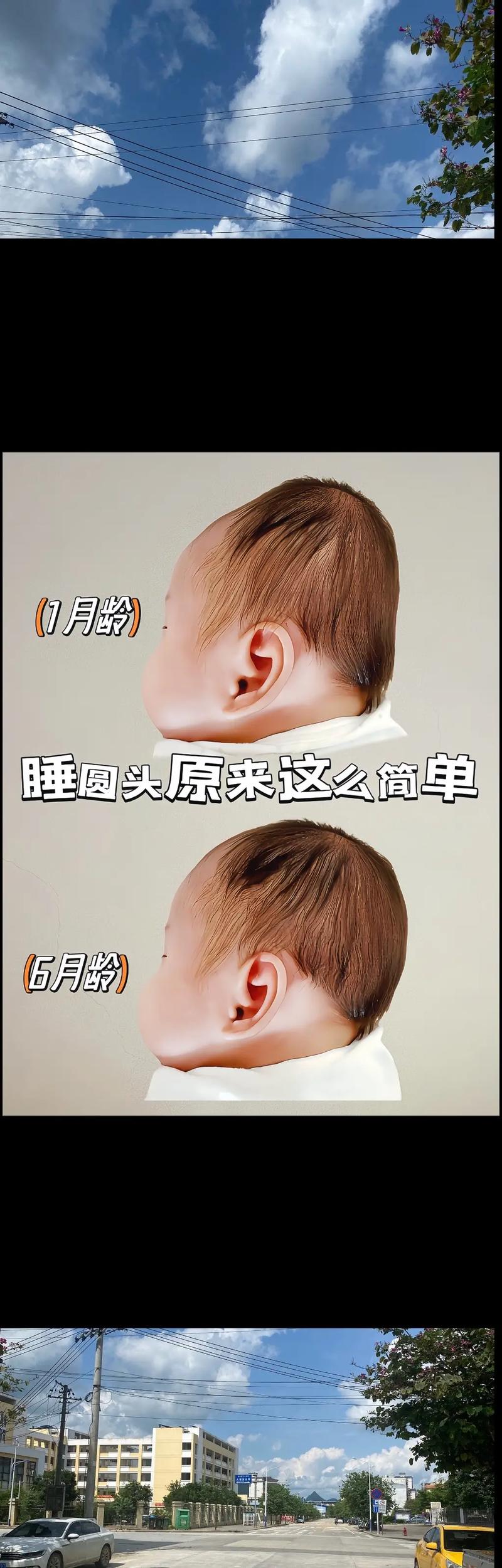 宝宝的头睡偏了怎么办