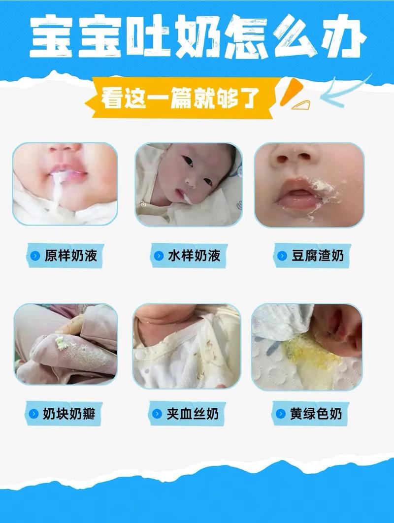 宝宝喝奶就吐怎么回事